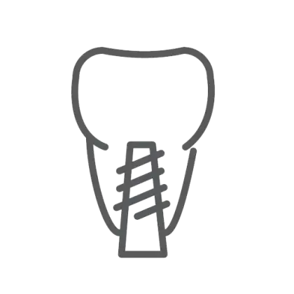Dental Implant Diagram Outline