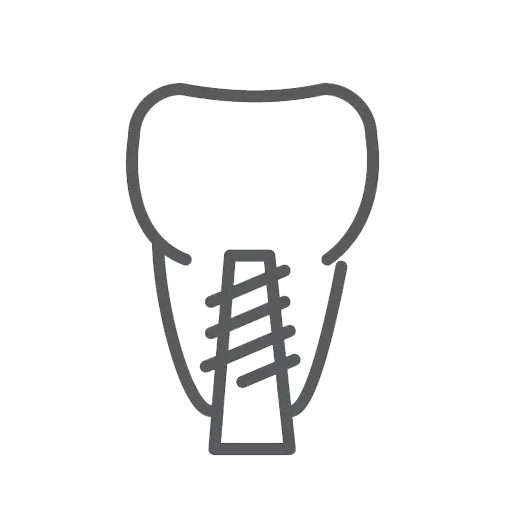 Dental Implant Diagram Outline