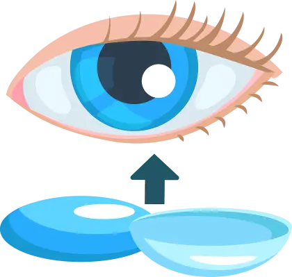 Eye and Contact Lenses Illustration