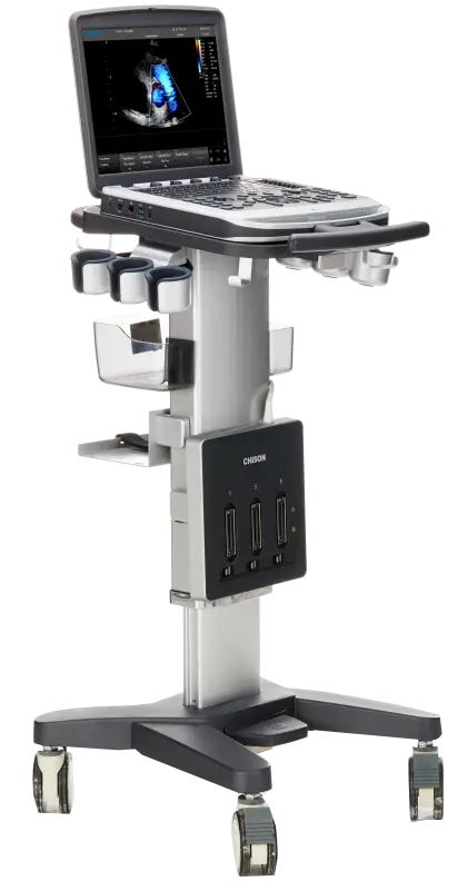 Medical Ultrasound Machine for Diagnostics