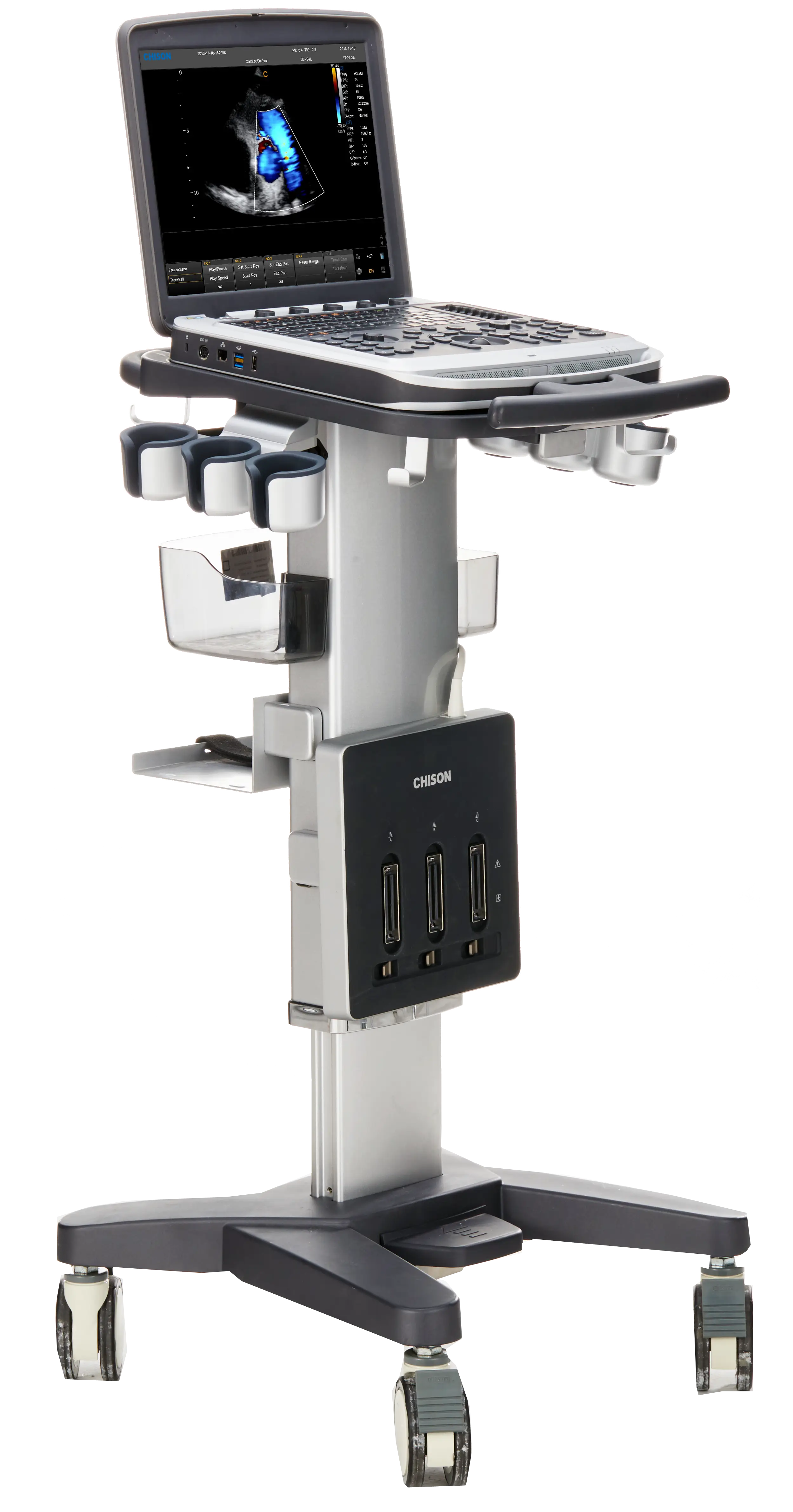 Medical Ultrasound Machine for Diagnostics