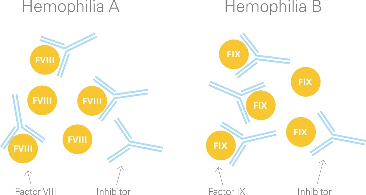 Hemophilia A and B Medical Diagram