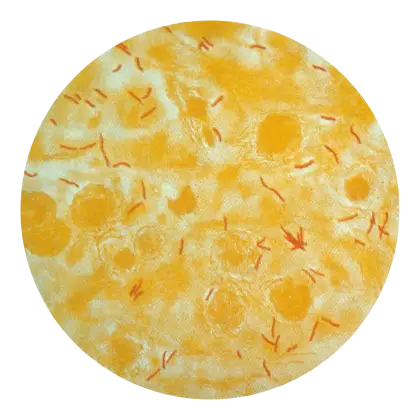 Yellow Bacteria Under Microscope