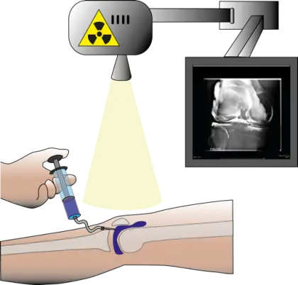 Illustration of Medical Procedure