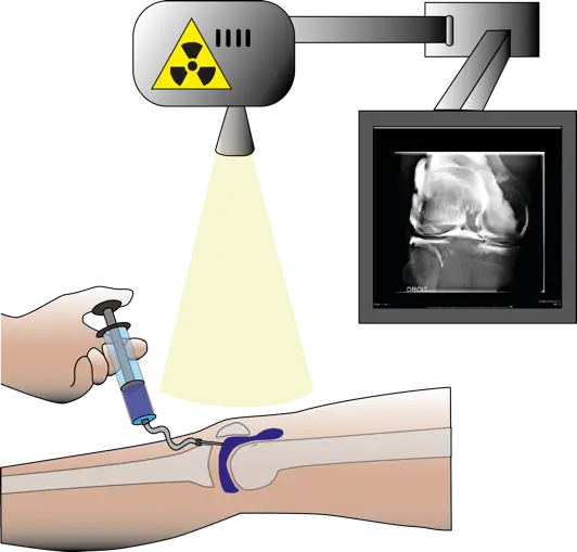 Illustration of Medical Procedure