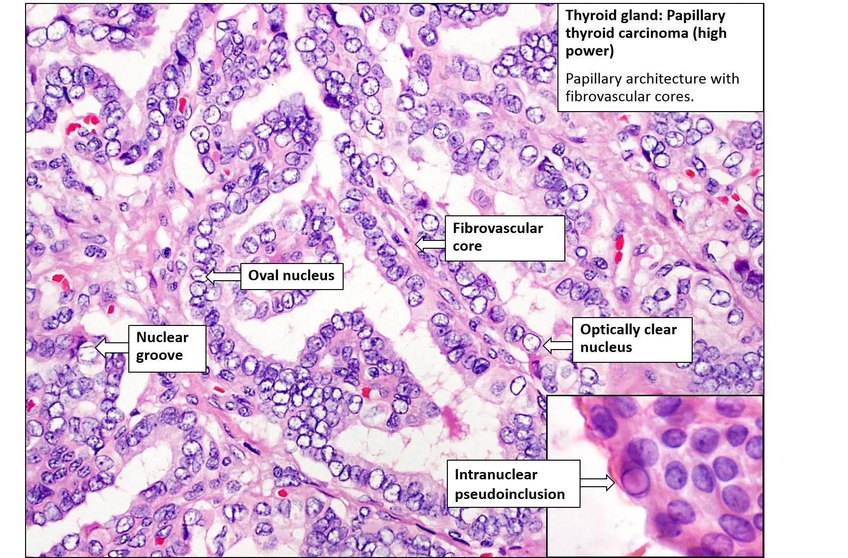 Thyroid Gland Histology Slide