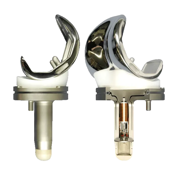 Metal Knee Implant