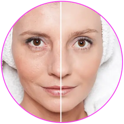 Before and After Skincare Comparison