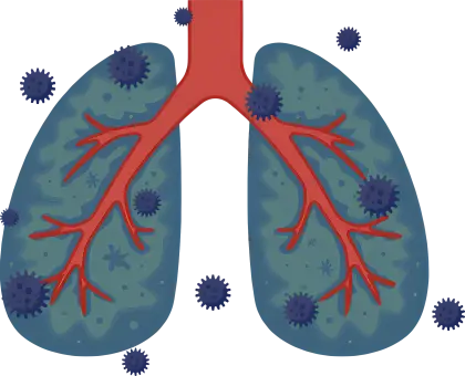 Illustration of Infected Lungs and Virus Particles