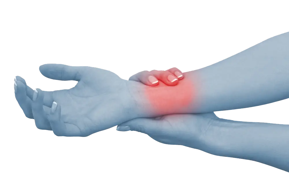 Wrist Pain Illustration