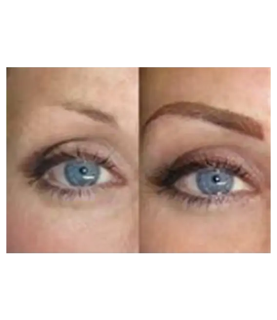 Eyebrow Enhancement Before and After