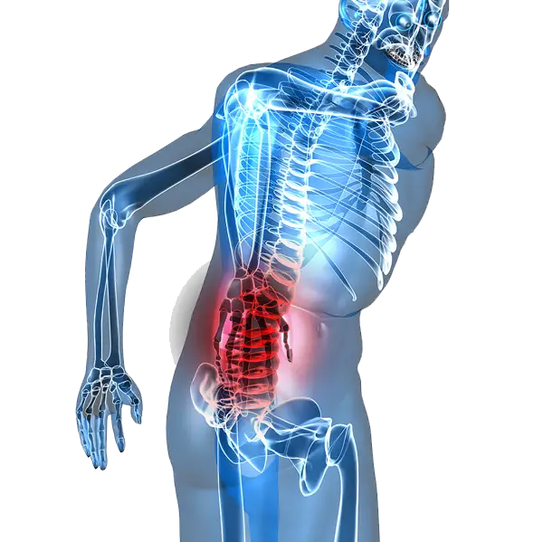 Human Skeleton Illustration with Back Pain Highlighted