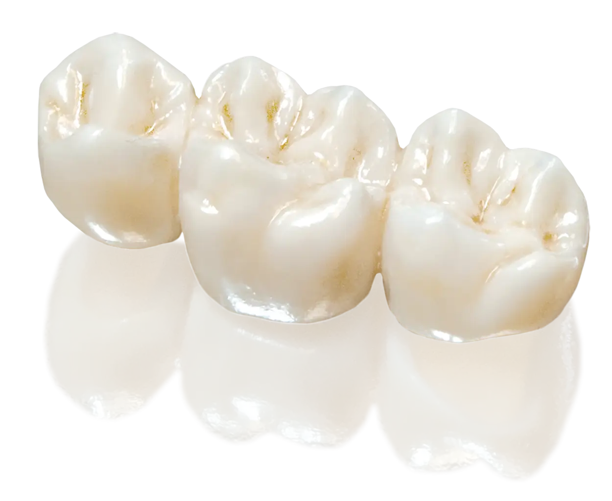 Dental Crowns