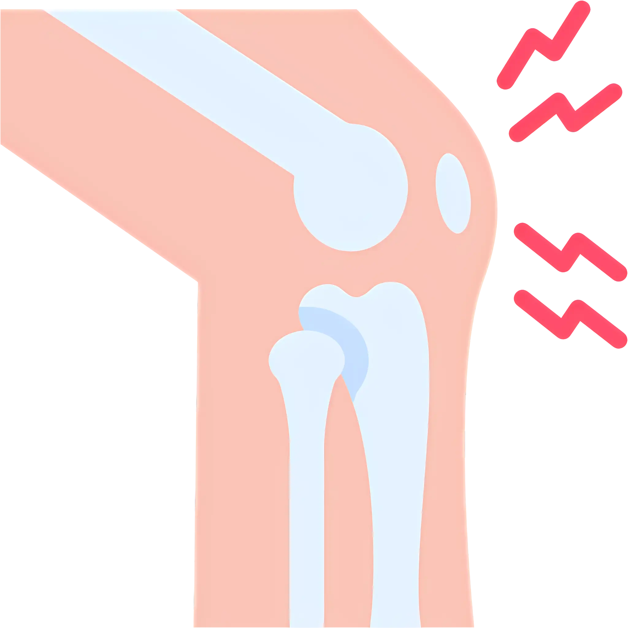 Illustration of Knee Joint Pain