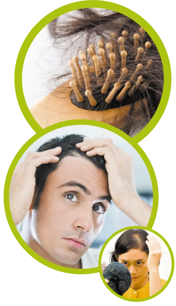 Hair Loss Concern