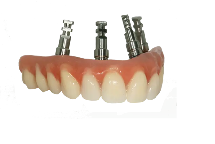 Dental Implants Prosthetics