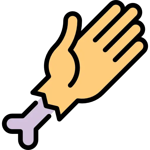 Human Arm Bone Cut Illustration