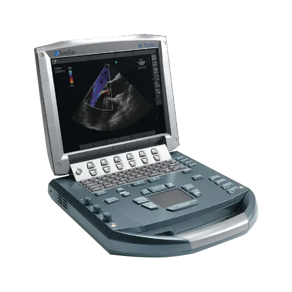 Portable Ultrasound Machine for Medical Diagnostics