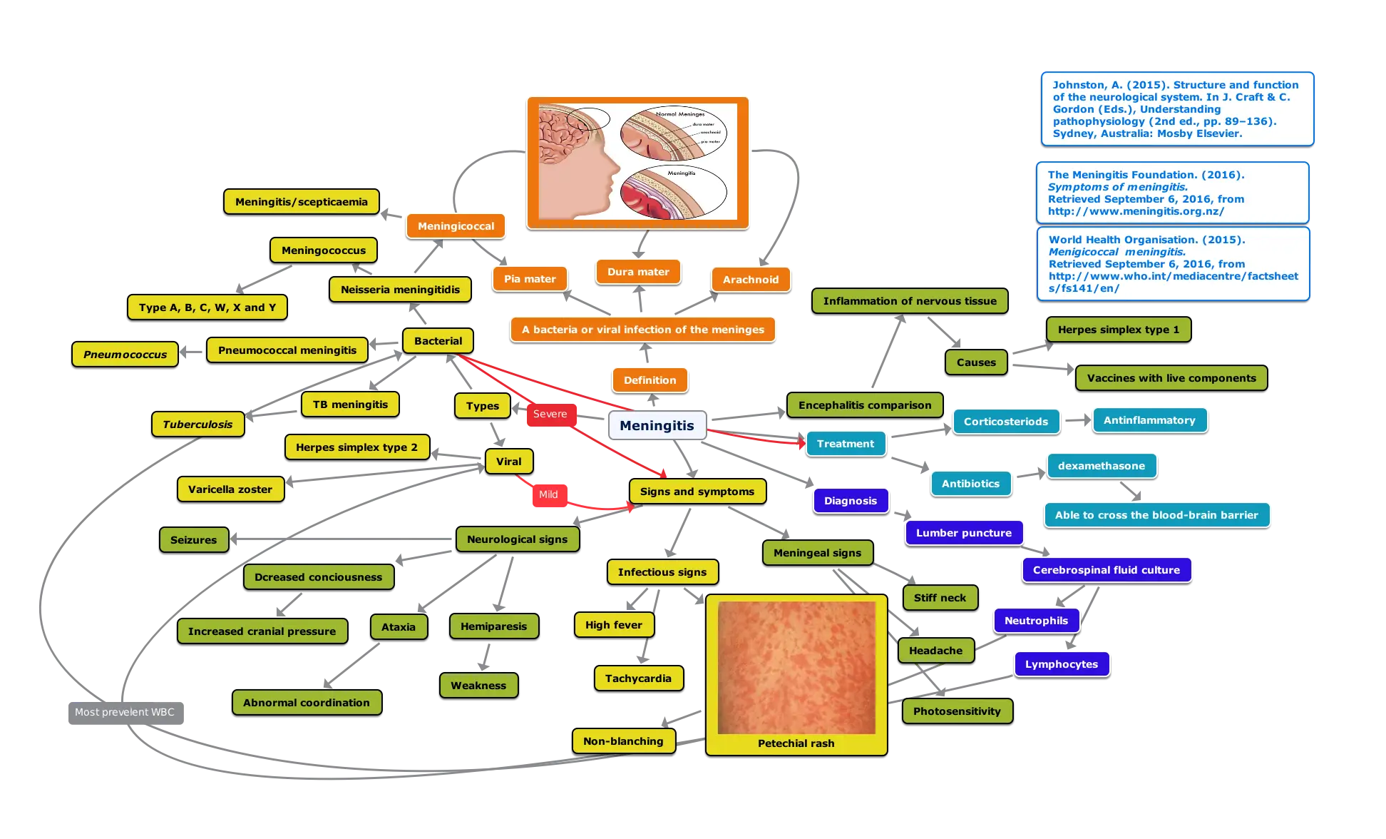 Meningitis Diagram for Medical Education