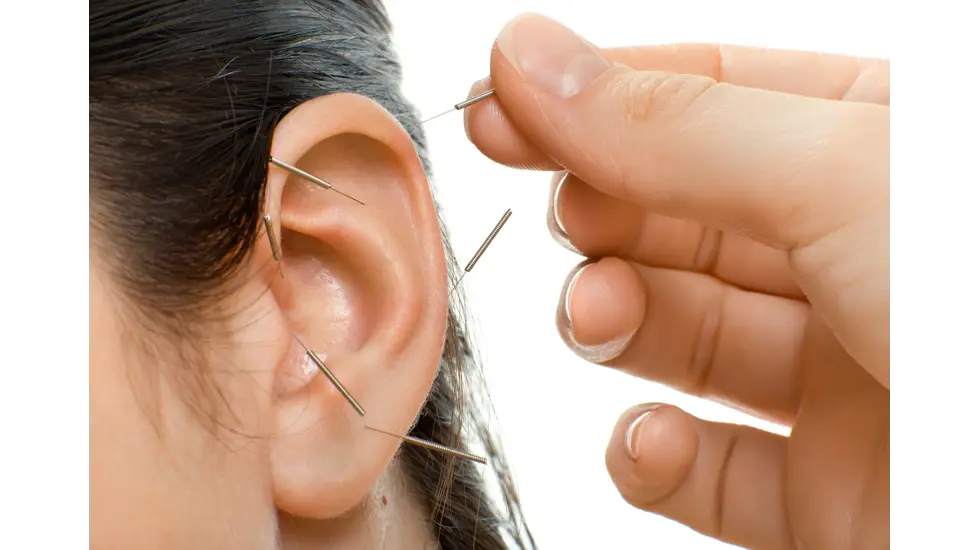 Ear Acupuncture with Needles