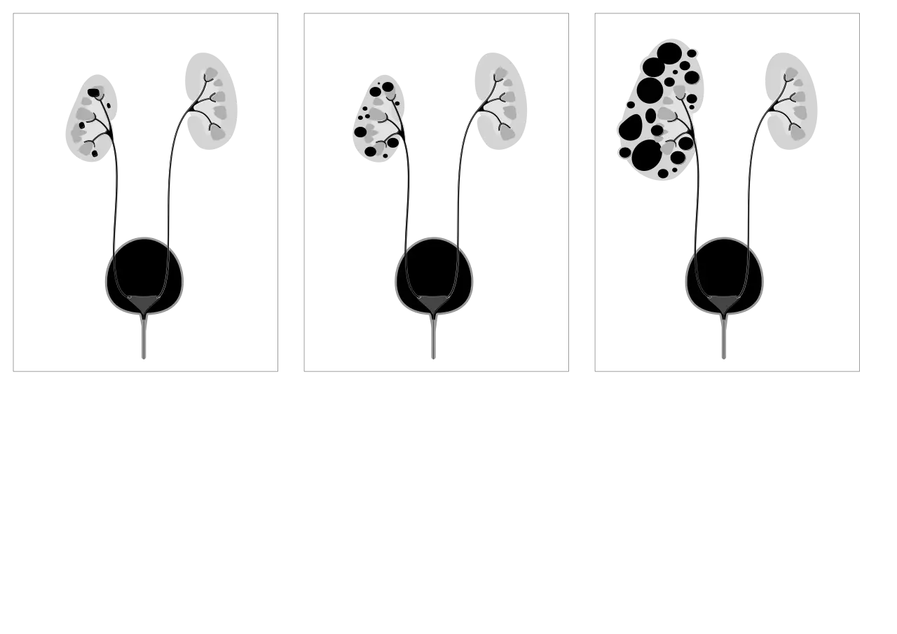 Medical Illustration of Kidneys