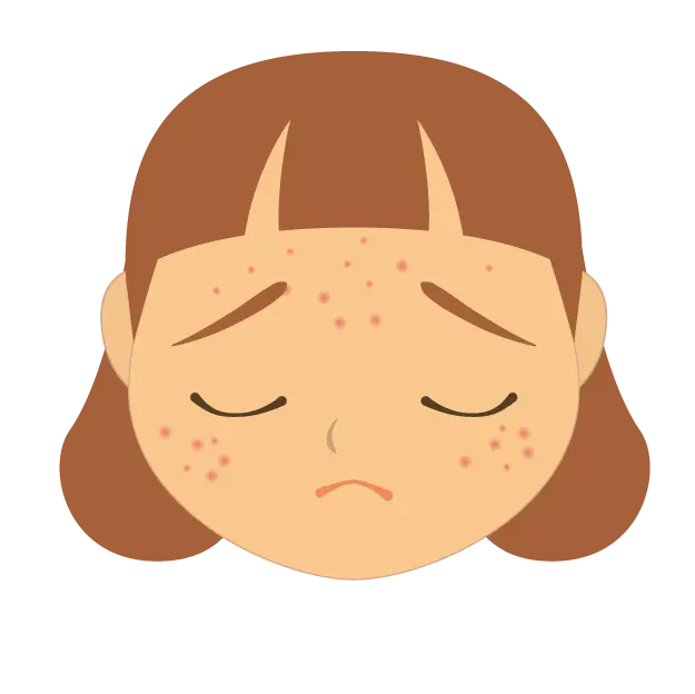 Sad Girl with Acne Illustration