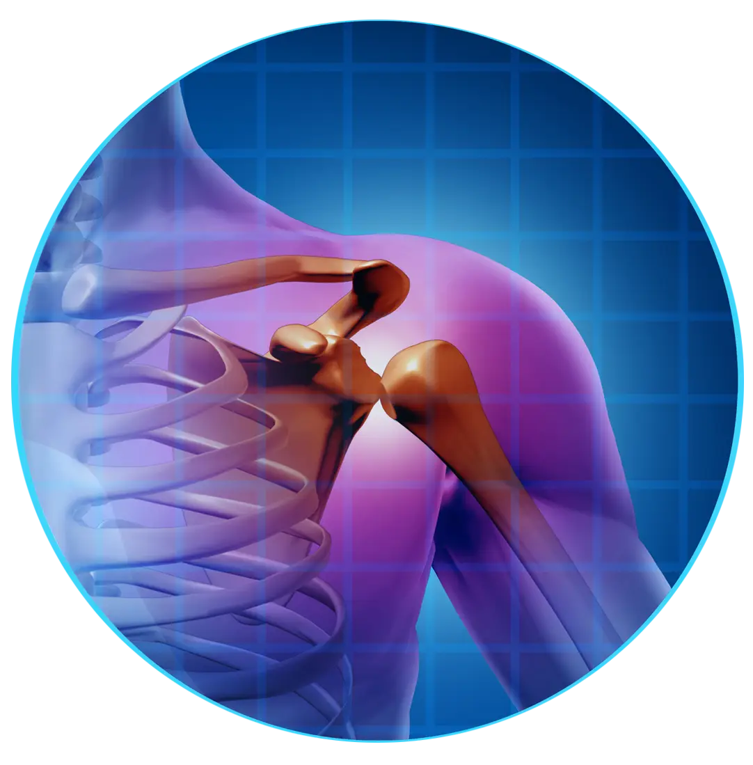 Shoulder joint anatomy with highlighted pain area