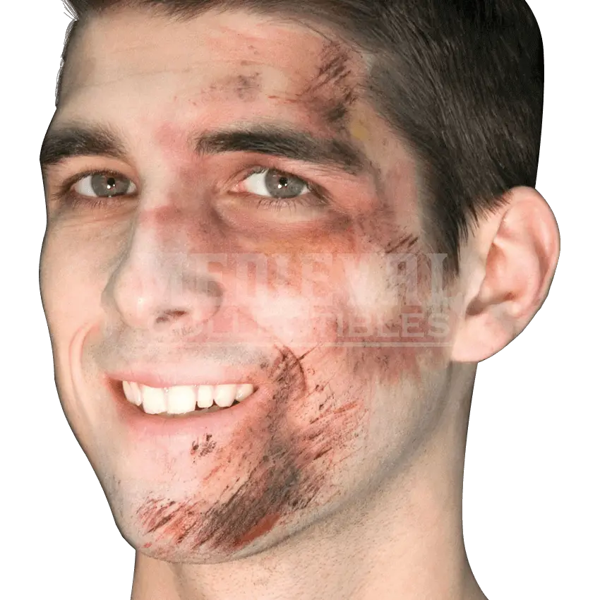 Injured Man Smiling
