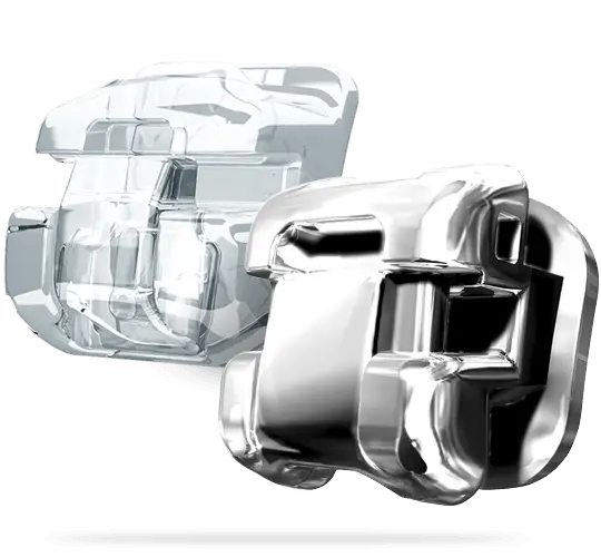 Orthodontic Braces