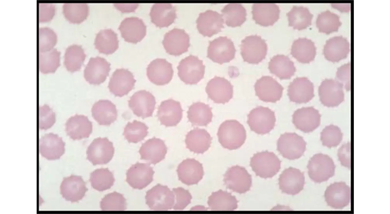 Microscopic View of Red Blood Cells