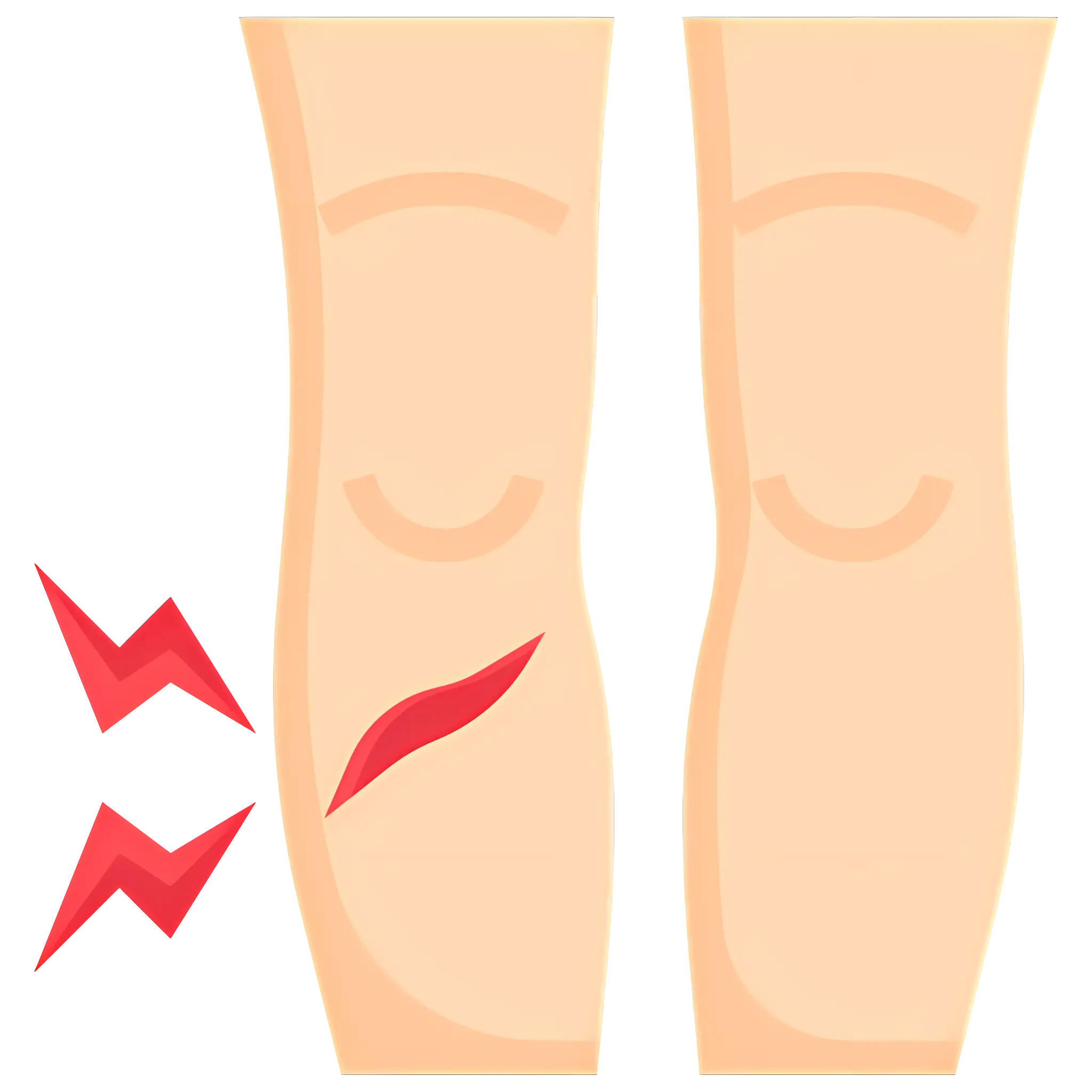 Illustration of Leg Injury