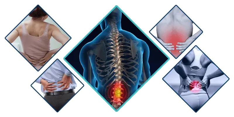 Back Pain and Spine Health