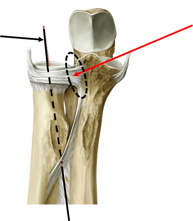 Detailed Bone Structure Illustration